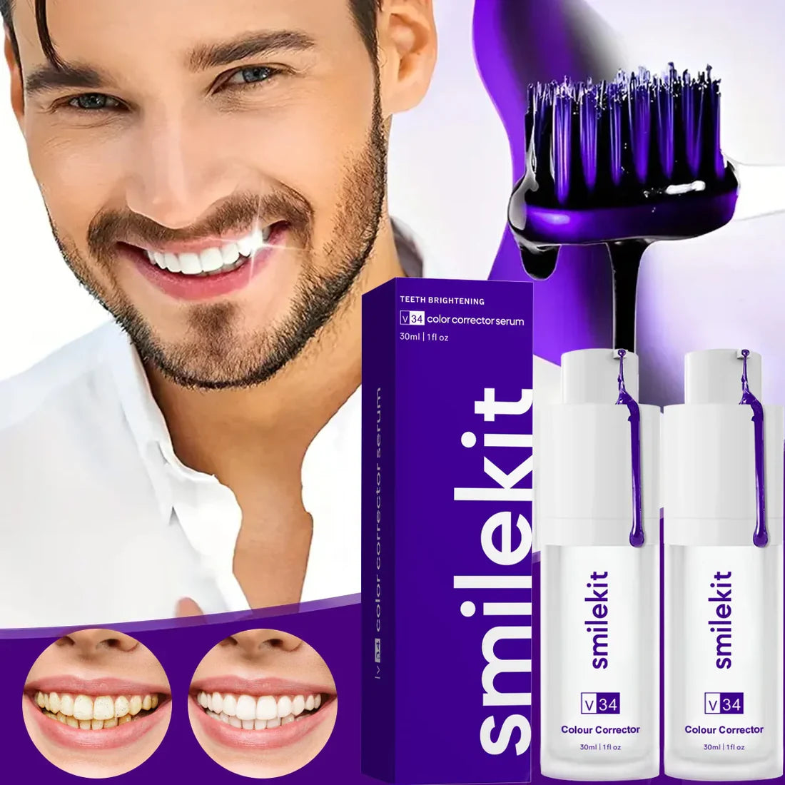 CREMA BLANQUEADORA SMILEKIT® | RECUPERA TU SONRISA