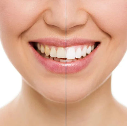 LÁMPARA BLANQUEADORA LED MYSMILE® | RECUPERA TU SONRISA